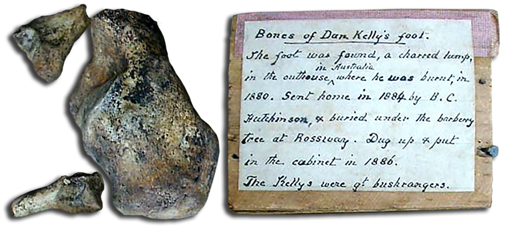 Ned and Dan Kelly’s Remains Ned and Dan Kelly’s Remains